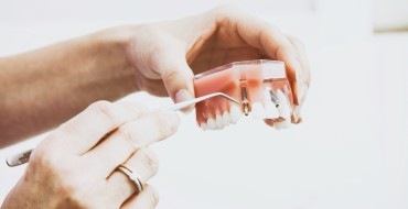 Targeting the Right Audience for Your Denture Services